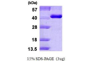 SDS-PAGE (SDS) image for Carbonic Anhydrase VIII (CA8) (AA 1-290) protein (His tag) (ABIN667660)