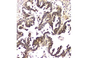 IHC analysis of MCUR1 using anti-MCUR1 antibody (ABIN6719261). (CCDC90A antibody)