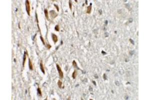 Immunohistochemistry of TSHZ3 in mouse brain tissue with TSHZ3 / ZNF537 Antibody at 2. (TSHZ3 antibody  (N-Term))