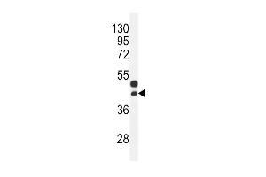 CTGF Antibody (Center) (ABIN392205 and ABIN2841905) western blot analysis in mouse bladder tissue lysates (35 μg/lane). (CTGF antibody  (AA 134-159))