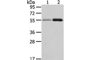 Western Blot analysis of Human normal stomach and thyroid cancer tissue using XKR3 Polyclonal Antibody at dilution of 1/330