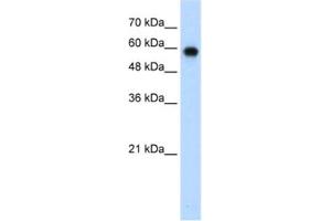 Western Blotting (WB) image for anti-SWI/SNF Related, Matrix Associated, Actin Dependent Regulator of Chromatin, Subfamily D, Member 2 (SMARCD2) antibody (ABIN2461675)