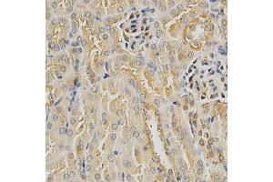 Immunohistochemistry of paraffin-embedded mouse kidney using HDAC6 antibody (ABIN5997884) at dilution of 1/100 (40x lens). (HDAC6 antibody)