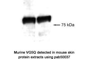 Image no. 1 for anti-Angiogenic Factor with G Patch and FHA Domains 1 (AGGF1) (AA 300-400) antibody (ABIN363346) (AGGF1 antibody  (AA 300-400))