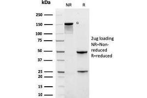 SDS-PAGE Analysis Purified KRT6A Recombinant Mouse Monoclonal Antibody (rKRT6A/2100).