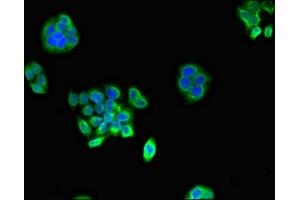 Immunofluorescent analysis of PC-3 cells using ABIN7164944 at dilution of 1:100 and Alexa Fluor 488-congugated AffiniPure Goat Anti-Rabbit IgG(H+L) (PSMA1 antibody  (AA 163-263))