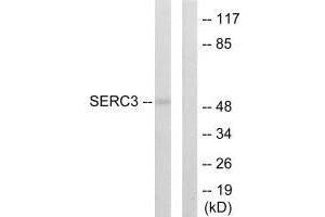 Western blot analysis of extracts from 293 cells, using SERC3 antibody. (SERINC3 antibody  (C-Term))