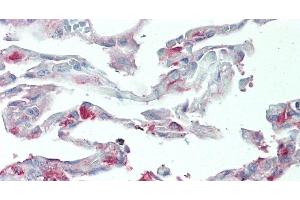 Immunohistochemistry of paraffin-embedded Human Lung tissue using SLC34A2 Polyclonal Antibody at dilution of 1:60.