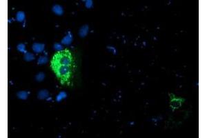 Anti-PDSS2 mouse monoclonal antibody (ABIN2455335) immunofluorescent staining of COS7 cells transiently transfected by pCMV6-ENTRY PDSS2 (RC207892). (PDSS2 antibody)