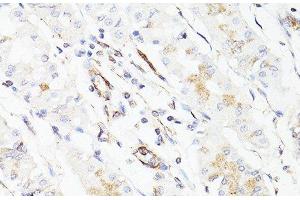 Immunohistochemistry of paraffin-embedded Human stomach using Vimentin Polyclonal Antibody at dilution of 1:150 (40x lens). (Vimentin antibody)