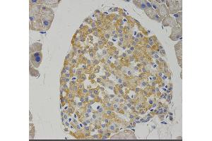 Immunohistochemistry (IHC) image for anti-gamma-aminobutyric Acid (GABA) B Receptor, 1 (GABBR1) (C-Term) antibody (ABIN6261856)