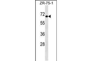 Western blot analysis in ZR-75-1 cell line lysates (35ug/lane). (GTF3C5 antibody  (AA 287-316))