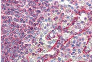 Human Spleen (formalin-fixed, paraffin-embedded) stained with HLA-E antibody ABIN364251 at 10 ug/ml followed by biotinylated anti-mouse IgG secondary antibody ABIN481714, alkaline phosphatase-streptavidin and chromogen. (HLA-E antibody)