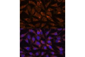 Immunofluorescence analysis of L929 cells using LM antibody (ABIN7268203) at dilution of 1:100. (LMAN2 antibody  (AA 190-320))