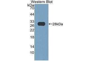 Western Blotting (WB) image for anti-Thyroid Peroxidase (TPO) (AA 636-832) antibody (ABIN1860845) (Thyroperoxidase antibody  (AA 636-832))