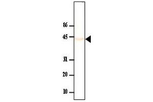 Western Blotting (WB) image for anti-Protein Phosphatase, Mg2+/Mn2+ Dependent, 1A (PPM1A) antibody (ABIN165454) (PPM1A antibody)