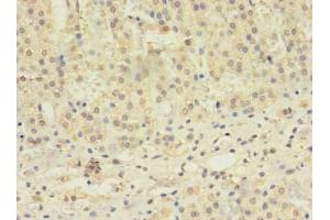 Immunohistochemistry of paraffin-embedded human adrenal gland tissue using ABIN7171610 at dilution of 1:100 (TBC1D2 antibody  (AA 1-237))