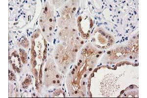 Immunohistochemical staining of paraffin-embedded Human Kidney tissue using anti-SULT1C2 mouse monoclonal antibody. (SULT1C2 antibody)