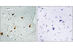 Immunohistochemistry analysis of paraffin-embedded human brain tissue, using STAT6 (Ab-641) Antibody.