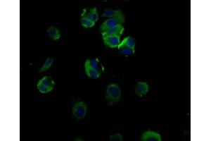 Immunofluorescence staining of MCF-7 cells with ABIN7172799 at 1:66, counter-stained with DAPI. (Transferrin Receptor 2 antibody  (AA 534-605))