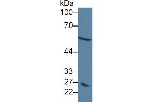 Western blot analysis of Human MCF7 cell lysate, using Human DCT Antibody (5 µg/ml) and HRP-conjugated Goat Anti-Rabbit antibody (