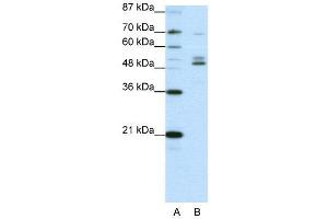 WB Suggested Anti-FOXA2  Antibody Titration: 0. (FOXA2 antibody  (C-Term))