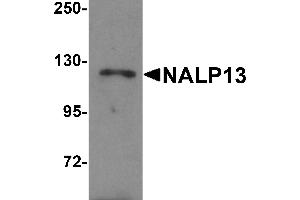 Western Blotting (WB) image for anti-NLR Family, Pyrin Domain Containing 13 (NLRP13) (N-Term) antibody (ABIN1031468) (NLRP13 antibody  (N-Term))