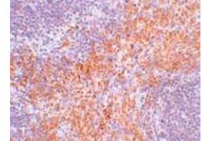Immunohistochemical staining of mouse kidney tissue with 2. (RIPK1 antibody  (N-Term))