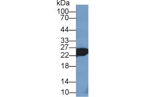 Detection of TNNI2 in Mouse Skeletal muscle lysate using Polyclonal Antibody to Troponin I Type 2, Fast Skeletal (TNNI2) (TNNI2 antibody  (AA 1-182))