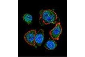 Confocal immunofluorescent analysis of  MITF Antibody (N-term) Cat. (MITF antibody  (N-Term))