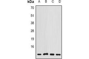 Western blot analysis of COX7A2L expression in MCF7 (A), A549 (B), Hela (C), mouse brain (D) whole cell lysates. (COX7A2L antibody)