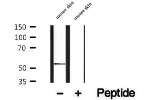 Western blot analysis of extracts of mouse skin tissue, using PDIA6 antibody. (PDIA6 antibody  (C-Term))