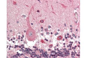 Immunohistochemistry (IHC) image for anti-Potassium Intermediate/small Conductance Calcium-Activated Channel, Subfamily N, Member 1 (KCNN1) (AA 441-490) antibody (ABIN6755271)