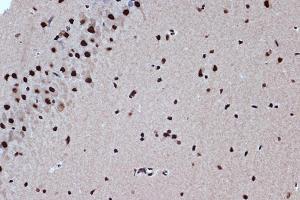 Immunohistochemistry of paraffin-embedded rat brain using BUB3 Rabbit mAb (ABIN7265960) at dilution of 1:100 (40x lens).