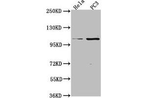 Western Blot Positive WB detected in: Hela whole cell lysate, PC3 whole cell lysate All lanes: PKN3 antibody at 1:2000 Secondary Goat polyclonal to rabbit IgG at 1/50000 dilution Predicted band size: 100 kDa Observed band size: 100 kDa (PKN3 antibody  (AA 1-252))