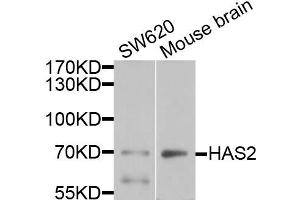 Western blot analysis of extracts of various cells, using HAS2 antibody. (HAS2 antibody)