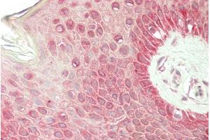ABIN870681 (5µg/ml) staining of paraffin embedded Human Skin. (RHCG antibody  (N-Term))