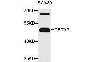 Western blot analysis of extracts of SW480 cells, using CRTAP antibody. (CRTAP antibody)