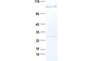 Western Blotting (WB) image for Receptor-Interacting serine-threonine Kinase 3 (RIPK3) protein (GST tag) (ABIN2730958)
