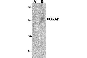 Western Blotting (WB) image for anti-ORAI Calcium Release-Activated Calcium Modulator 1 (ORAI1) antibody (ABIN1031712) (ORAI1 antibody)
