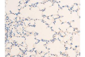 Immunohistochemistry (IHC) image for anti-Heat Shock Protein, alpha-Crystallin-Related, B6 (HSPB6) (pSer16) antibody (ABIN6256161)