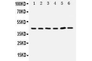 Anti-TRAM1 antibody, Western blotting Lane 1: Rat Brain Tissue Lysate Lane 2: Rat Kidney Tissue Lysate Lane 3: 293T Cell Lysate Lane 4: RAJI Cell Lysate Lane 5: JURKAT Cell Lysate (TRAM1 antibody  (C-Term))