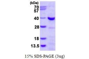 CHMP4A Protein (AA 1-265) (His tag)