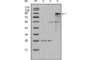 Western Blot showing MPO antibody used against truncated Trx-MPO recombinant protein (1),truncated MBP-MPO (aa1-193) recombinant protein (2) and truncated MPO (aa165-745)-hIgGFc transfected CHO-K1 cell lysate (3). (Myeloperoxidase antibody  (AA 1-193))
