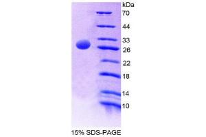 SDS-PAGE (SDS) image for ATG7 Autophagy Related 7 (ATG7) (AA 23-238) protein (His tag) (ABIN2127160) (ATG7 Protein (AA 23-238) (His tag))