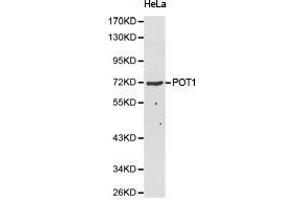 Western Blotting (WB) image for anti-Protection of Telomeres 1 (POT1) antibody (ABIN2650945) (POT1 antibody)