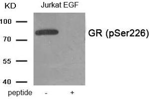 Western blot analysis of extracts from Jurkat cells treated with EGF using Phospho-GR (Ser226) antibody. (Glucocorticoid Receptor antibody  (pSer226))