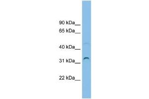 WB Suggested Anti-SECTM1 Antibody Titration: 0. (SECTM1 antibody  (Middle Region))