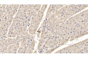Detection of MYH4 in Human Cardiac Muscle Tissue using Monoclonal Antibody to Myosin Heavy Chain 4, Skeletal Muscle (MYH4) (MYH4 antibody  (AA 1633-1875))