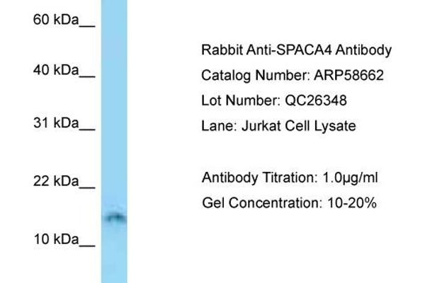 SPACA4 Antikörper  (N-Term)